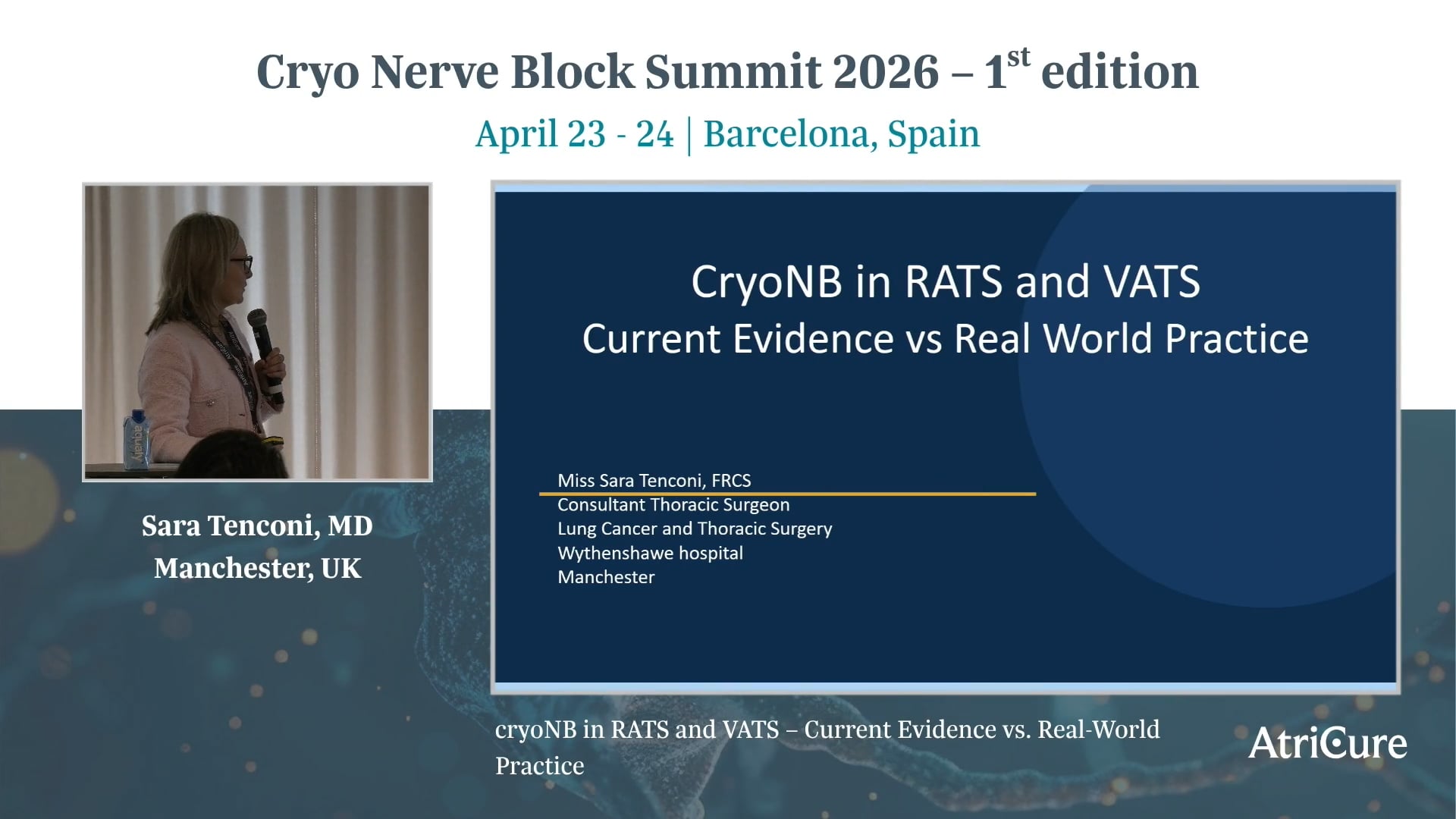 cryoNB in RATS and VATS – Current Evidence vs. Real- World Practice